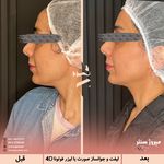 مرکز پزشکی و زیبایی میروژ سنتر