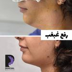 کلینیک زیبایی پوست و مو و لیزر پامچال