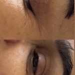 خدمات تخصصی پوست و فیشال سندی