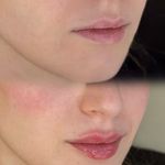 کلینیک لیزر و  زیبایی ملیح