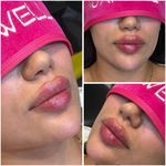 مجموعه لیزر و زیبایی کارنا(شاتی نداریم)