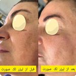 کلینیک پوست و مو زیبایی اُکتا - کرج - 7334