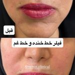 کلینیک پوست مو لیزر ونوس