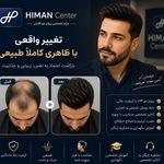 پروتز مو هیمن