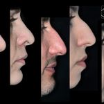 فتوگرافی پزشکی مظلومی