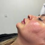 کلینیک زیبایی لیلاک