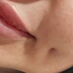 خدمات کاشت ناخن چال گونه پیرسینگ