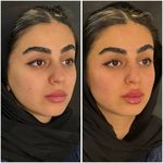 مجموعه لیزر و زیبایی کارنا(شاتی نداریم)