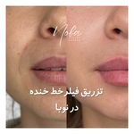 کلینیک زیبایی و لیزر مو زائد نوبا