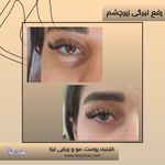 مطب پوست مو زیبایی فردوس شرق