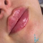 کلینیک زیبایی برنا