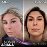 کلینیک پوست مو و زیبایی نوین ایرانا