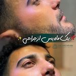 دکتر فرهاد محرابی سی سخت
