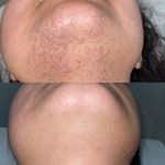 کلینیک لیزر موهای زائد نیوانتا