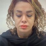 کلینیک زیبایی شایلی