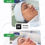 سالن زیبایی مراقبت پوست ،فیشال