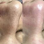 فیشال تخصصی سارا سمائی منش