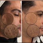 کلینیک زیبایی پوست و لیزر آلن