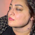 کلینیک زیبایی الماس کاملا اقساطی