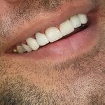مطب ایمپلنت دکتر نیما شفیعی