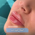 مطب پوست زيبايی ليزر دکتر شاه نعمت الهی