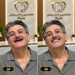 لابراتواردندانسازی ملیکااسماعیلی