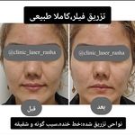 کلینیک تخصصی لیزر و زیبایی راشا