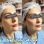 مرکز تخصصی لیزر و زیبایی سعادت آباد