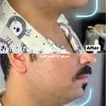 کلینیک تخصصی پوست و زیبایی ملینا