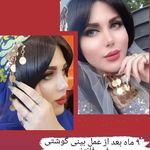 مطب زیبایی بینی و صورت دکتر تابان فر