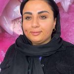 مرکز پیرسینگ،چال لپ و میکرودرمال ایدا