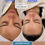 خدمات فیشیال و پاکسازی پوست