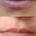 مرکز میکروبلیدینگ تخصصی(صادقی)
