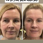 دکتر نیلوفر سلیمانی پوست و مو و زیبایی