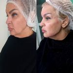کلینیک زیبایی پارسیان آلفا