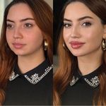 کلینیک پوست وزیبایی ومرکز تخصصی فیلربادی