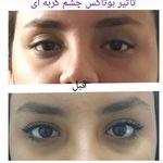 کلینیک پوست و مو و لیزر نیلوفر آبی