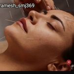 طب سوزنی زیبایی