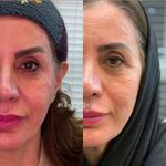 کلینیک پوست و زیبایی ولاغری تاج عظیمیه