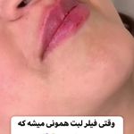 کلینیک زیبایی و مرکز لیزر و لاغری نیکشا