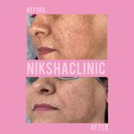 مطب زیبایی و مرکز لیزر نیکشا