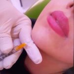 خدمات ژل و بوتاکس شقایق