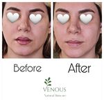 خدمات پوست ونوس