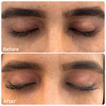 دکترمحیاعابدینی(تک متخصص پوست خانم ساوه)