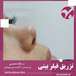 کلینیک تخصصی پوست و کاشت مو بهبد لیزر