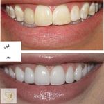 کلینیک دندانپزشکی دیجیتال باران
