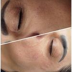 فیشیال / خدمات پوست / سالن زیبایی