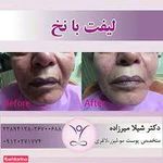 دکتر شیلا میرزاده