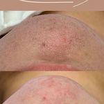 کلینیک فیشال و ماساژ سارن اسکین سارا