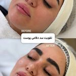 خدمات فیشال و پاکسازی پوست افروز